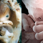 Embryon de 7 semaines ; fœtus de 8 semaines